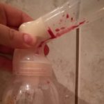 Uszkodzenia brodawek – szczególny przypadek mamy KPI